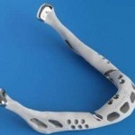titanium jaw